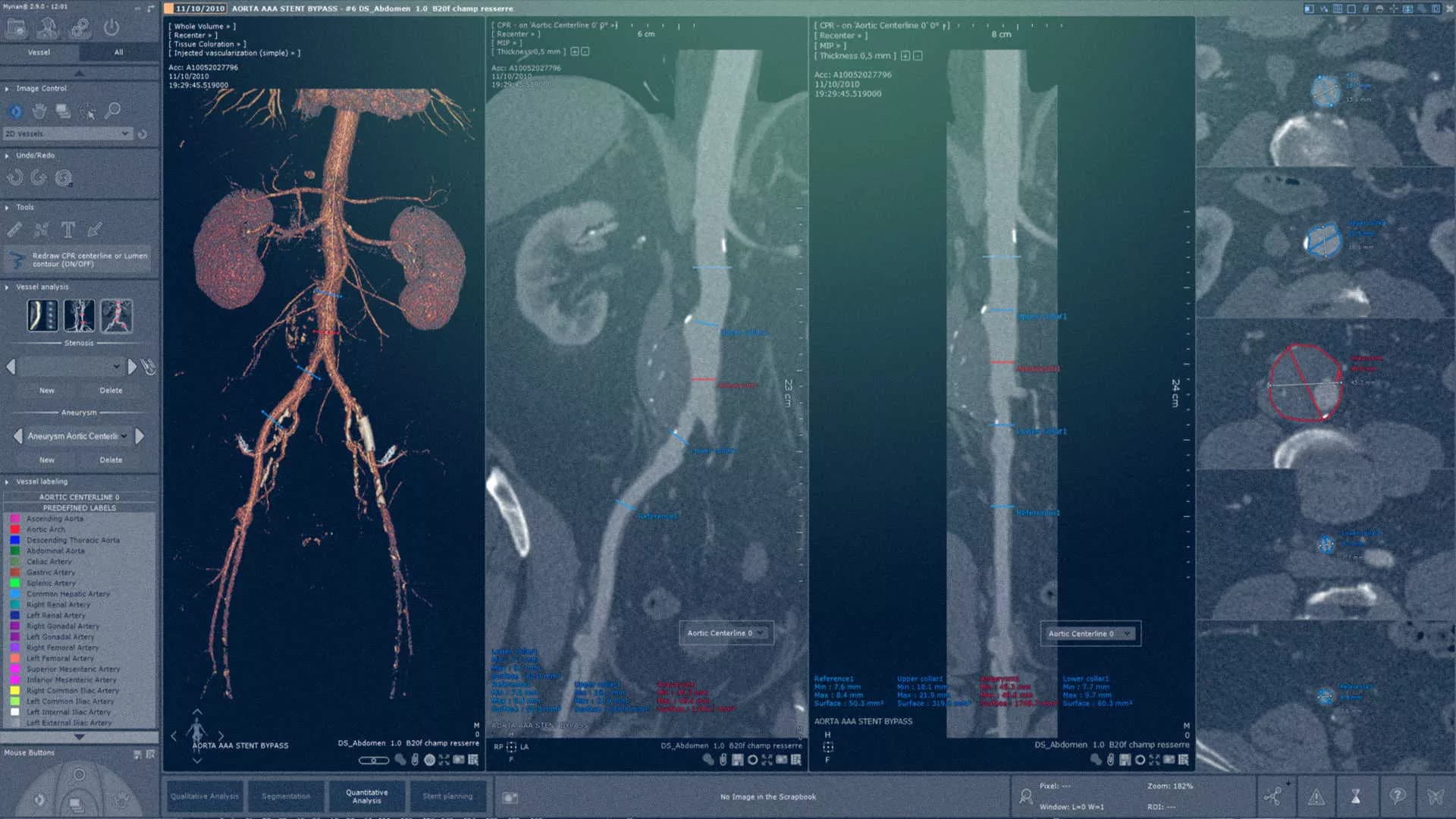 Capture d'écran du projet Intrasense – Application d'Imagerie Médicale avec IA